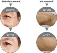 All you need is A Touch of Beauty to Look 10 Years Younger